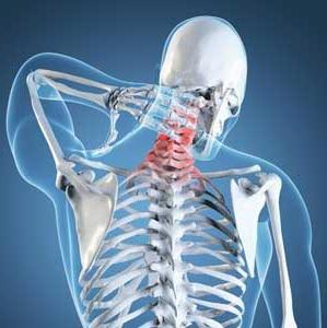 arthrosis unco-vertebral של עמוד השדרה הצוואר